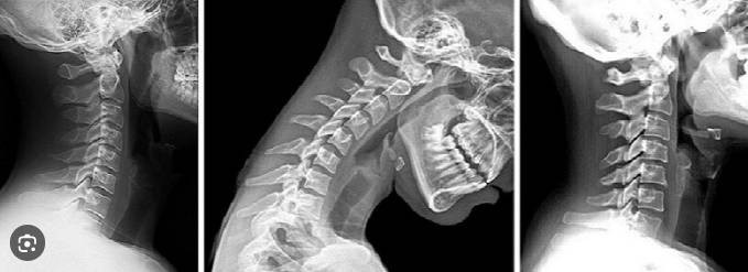 Beyin ve hafızanın en büyük düşmanı. Gençleri hedef alıyor. Alzheimer'a sebep oluyor - Resim: 5